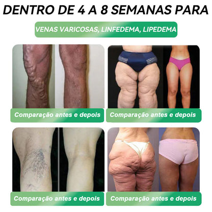 Loja Oficial |𝑯𝑯𝑽𝑩®✨𝑺𝒐𝒍𝒖çã𝒐 𝒐𝒓𝒂𝒍 𝒍í𝒒𝒖𝒊𝒅𝒂 𝑮𝑳𝑷-1 𝒔𝒆𝒊𝒔 𝒆𝒎 𝒖𝒎 (Somente uma dose por dia, mudanças visíveis em 7 dias) 🌿 Para obesidade, saúde cardiovascular, diabetes, apneia do sono, problemas articulares e muito mais problemas articulares y más.