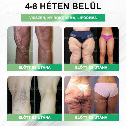 🌴🌴  DOOEKA® GLP-1 8 az 1-ben Fit & Vital Szájon át szedhető oldat – 👨‍⚕️ Napi egyszer, 7 nap alatt látható változás / Elhízás, szív- és érrendszeri egészség, cukorbetegség, alvási apnoe, bélrendszer egészsége, ízületi problémák és még sok más esetén